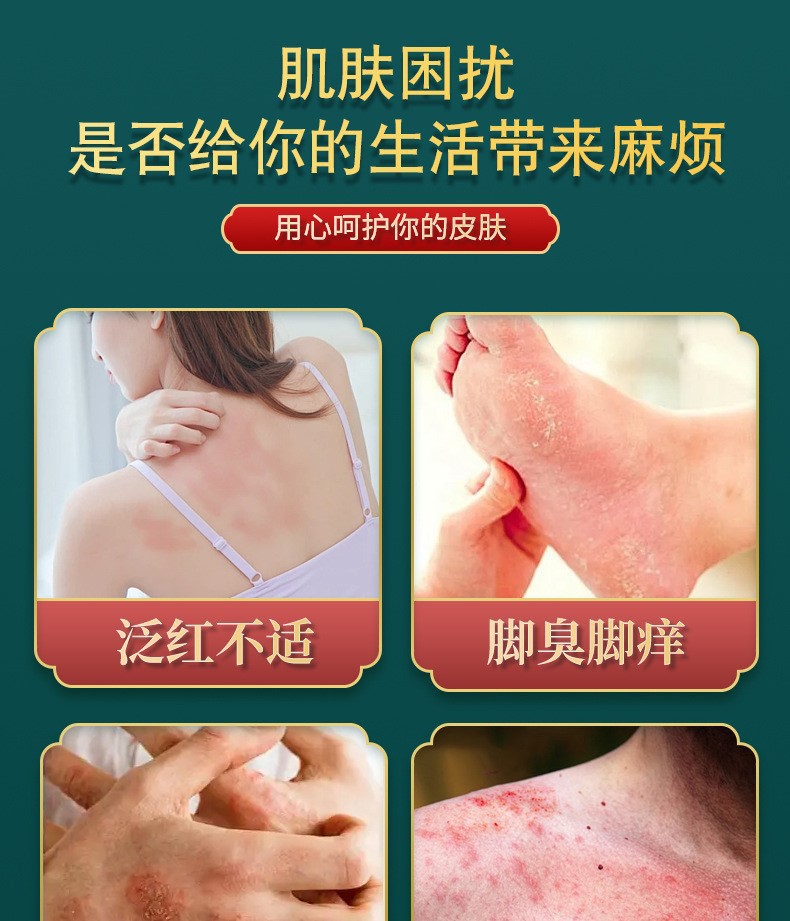 Five-Toxin Anti-Itch Cream, Plant-Based Mosquito Bite Cream, Dry Cracked Skin Itching Cream, Peeling Soothing Cream, Anti-Itch Herbal Antibacterial Cream detail image