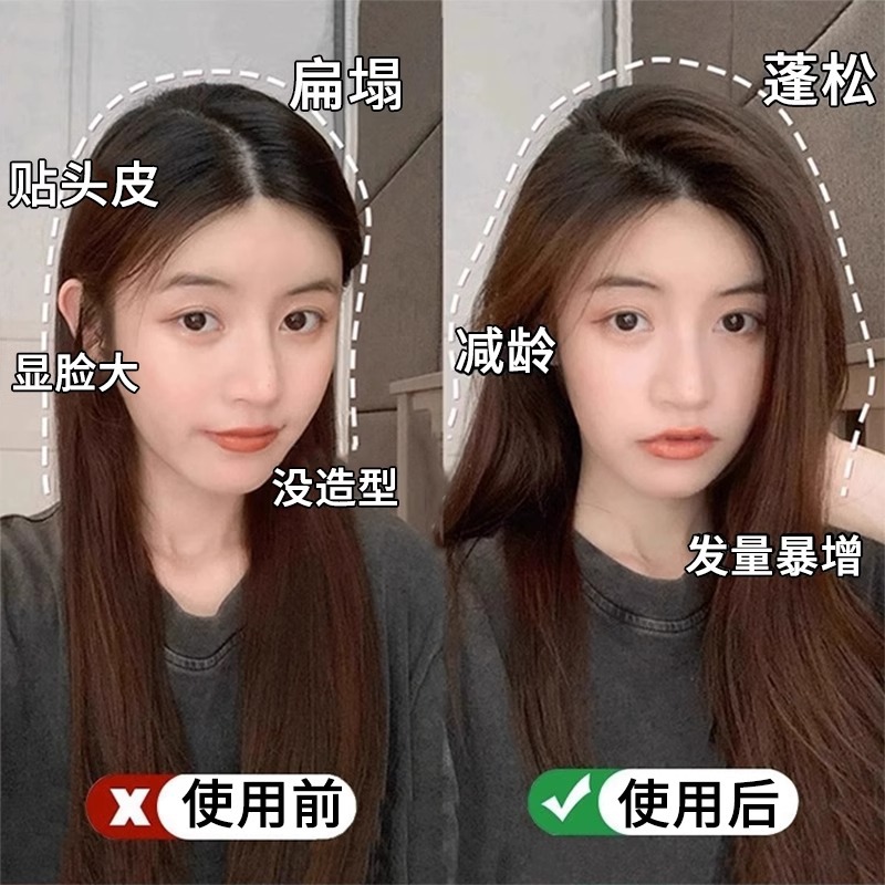 Clip de pelo esponjoso con raíz de pelo nueva 2025, artefacto de corona alta, clip de pelo sin costuras, clip de posicionamiento de flequillo de frente para mujer, clip de pelo