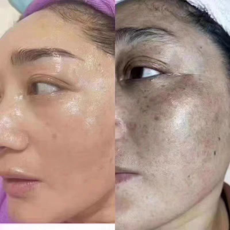 控色霜祛斑焕颜霜去黄褐斑雀斑抑制黑色素美白绿霜美容院专供批发|undefined