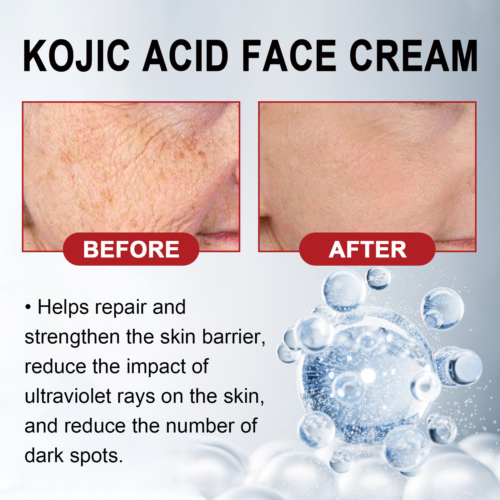 Jayswing kojic acid can lighten spots, repair the dark, white, brighten, wrinkle resistant and rejuvenating face cream_voghion.com
