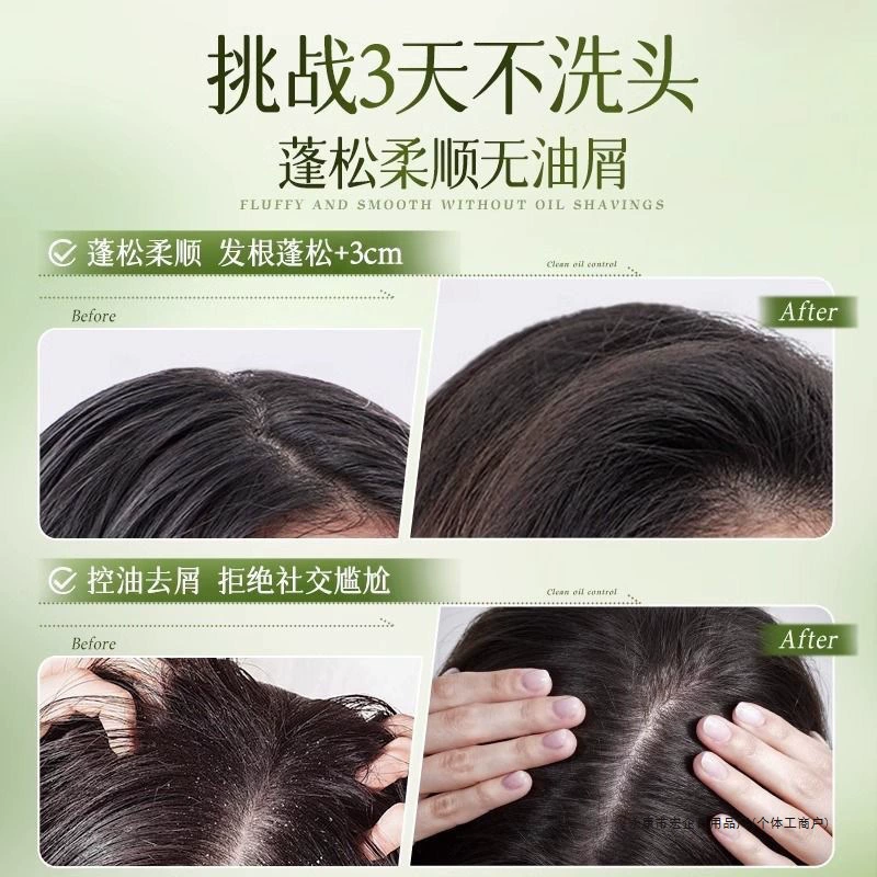 Шампунь Aozan Аминокислоты Контроль жирности Против перхоти Гладкий и шелковистый Улучшает вьющиеся волосы Женский аромат Гель для душа Стойкий аромат