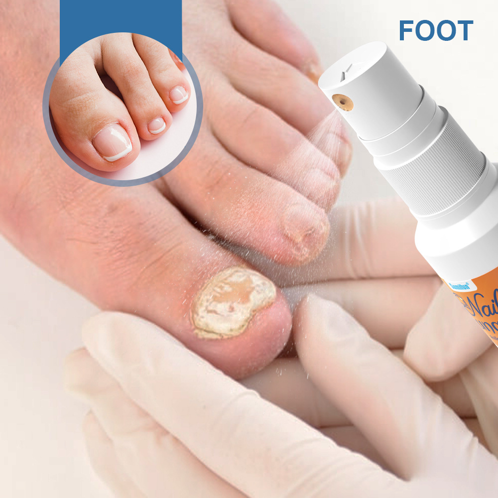 płyn do pielęgnacji paznokci w sprayu K50010_voghion.com