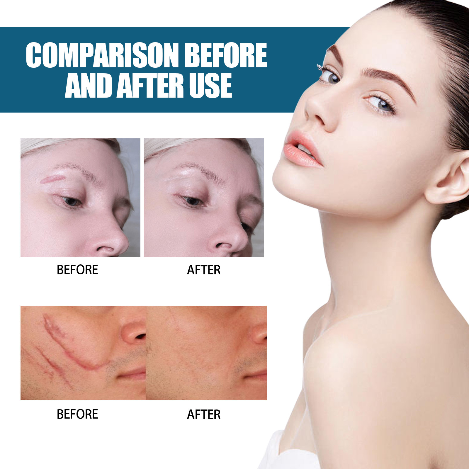 EELHOE Essence de réparation de cicatrices, estompe les cicatrices chirurgicales, essence de réparation de cicatrice de césarienne, lisse et hydrate la peau, (paquet de 3)_voghion.com