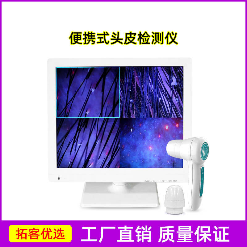 휴대용 두피 감지기
