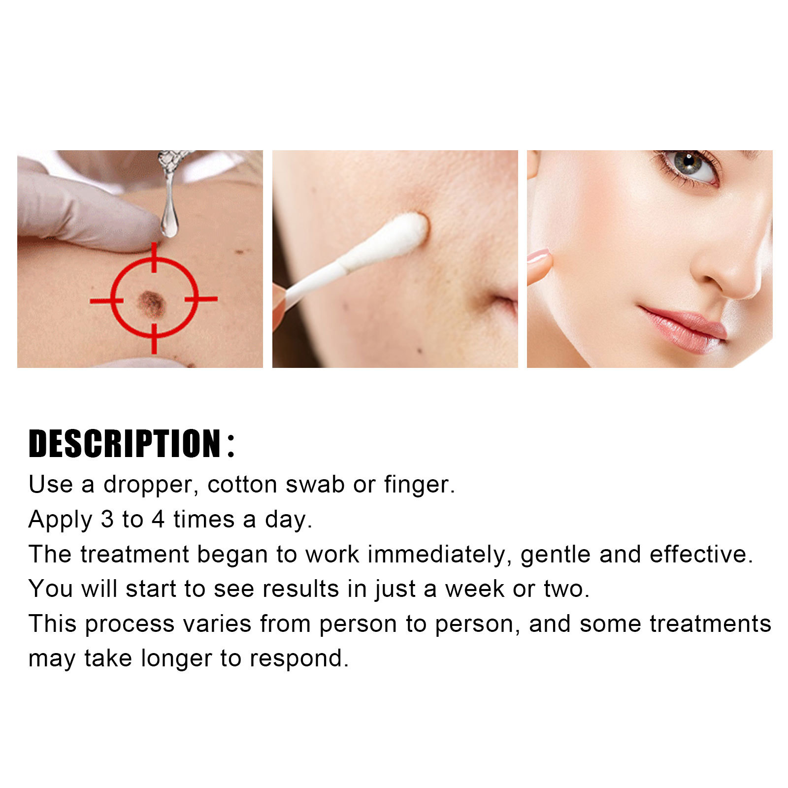 EELHOE repairing spots essence for skin flattening, wart removing and nevus eliminating solution_voghion.com