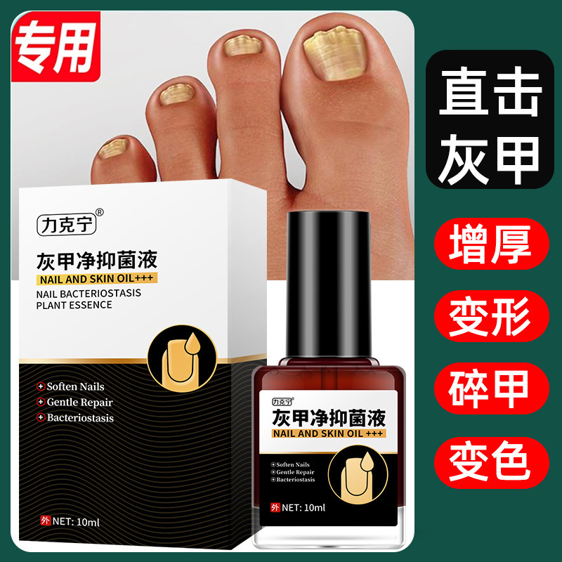 足の看護液の草本の抗菌液の灰色の爪の専用の薬の膏の悪い甲の灰色の爪の柔らかい甲は甲を脱ぐ膏の外用を使います。|undefined