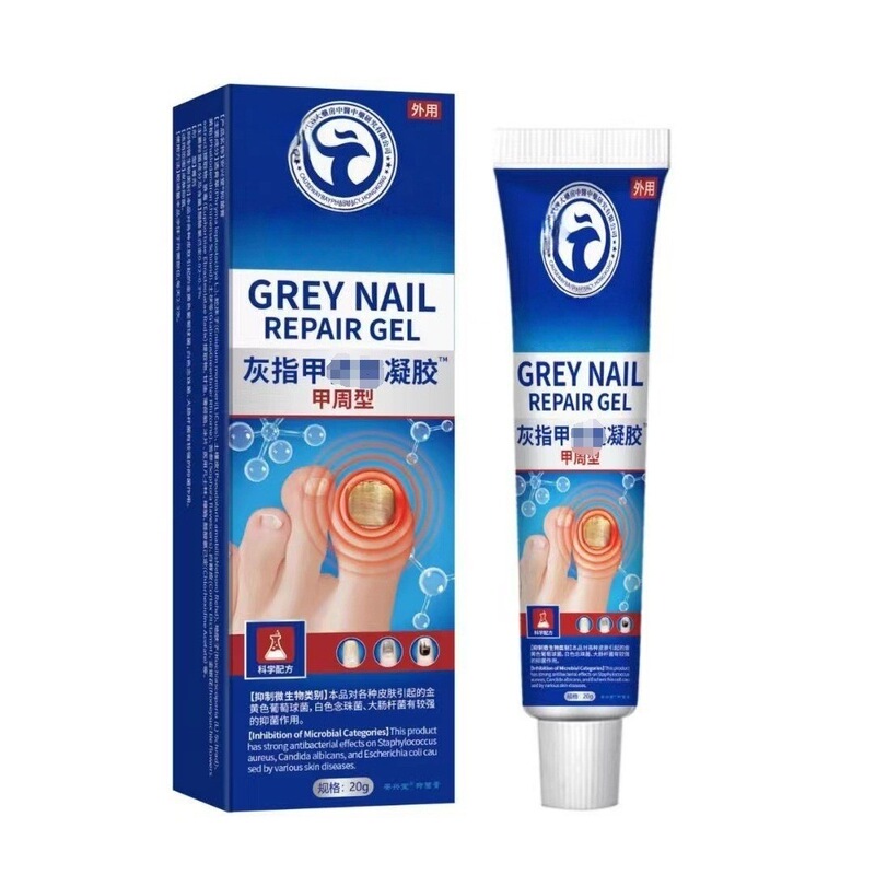 Wholesale Shuangcaitang Gray Nail Fungus Cream Herbal Ointment for Hands and Feet, E-Commerce Dropshipping
