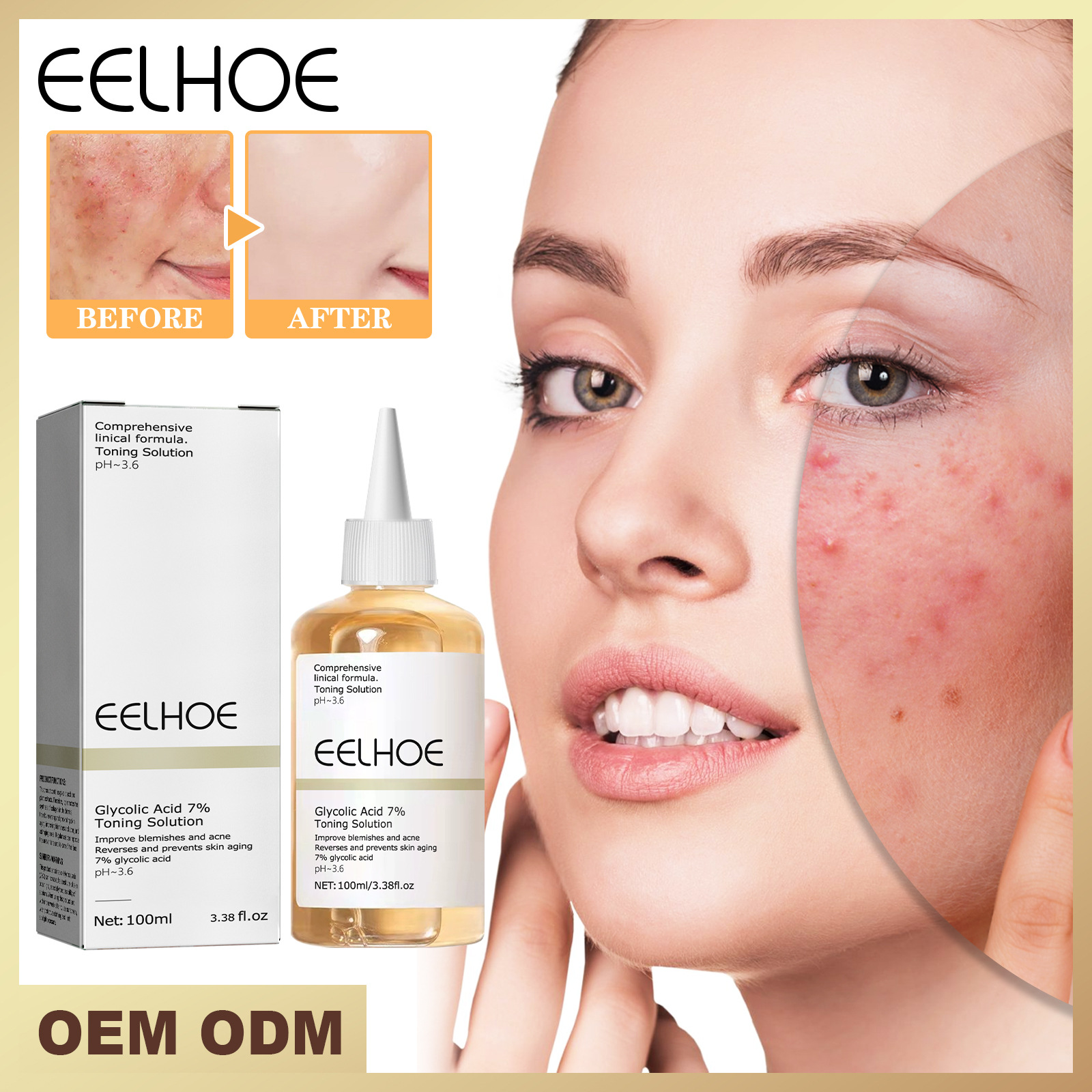 EELHOE Glycolic Acid 7% Toner Anti-acne Closed Moisturizing Pore Shrinking Skin Brightening Essence Water