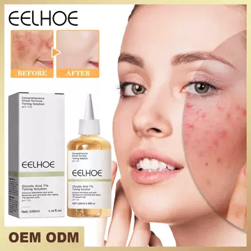 EELHOE Glycolic Acid 7% Toner Anti-acne Closed Moisturizing Pore Shrinking Skin Brightening Essence Water - ShopShipShake