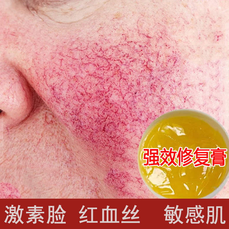 高效修复膏去红血丝激素脸修复敏感肌增厚角质层退红修复霜角质层|undefined