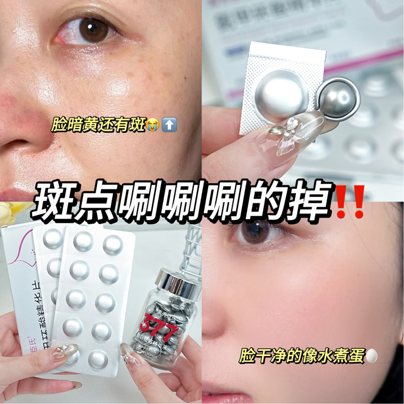 Su Xiuchen のトロンビン酸エッセンス タブレット + 377 美白およびそばかす防止エッセンス カプセルは、乾燥を改善し、肌を明るく若返らせます。|undefined