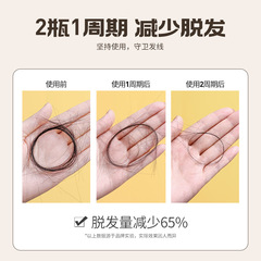 Three Magic Hair Crafters Ginger Shampoo for Hair Loss Prevention, Hair Growth, Oil Control, Unisex Hair Wash