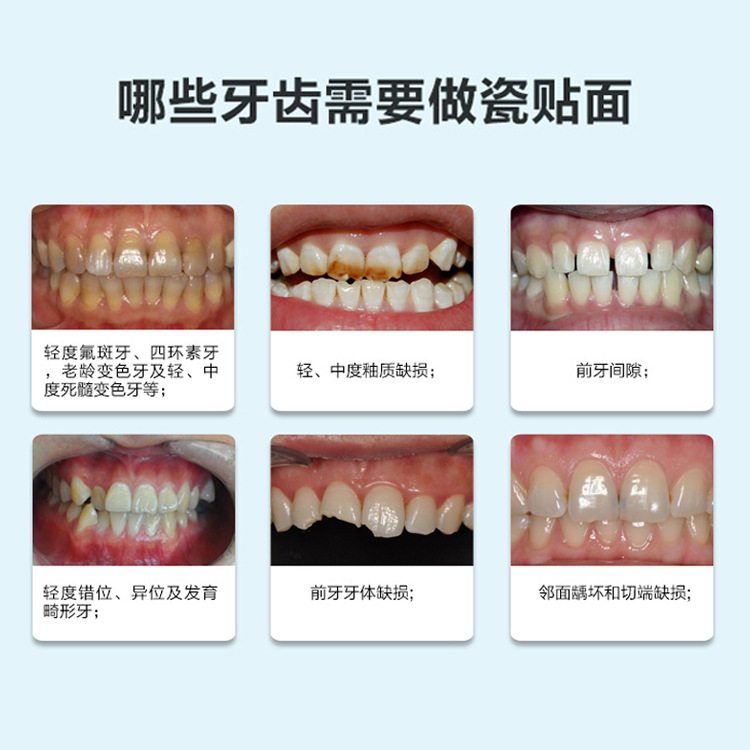 Parche de cerámica sin metal Eyingjia Denberg porcelana azul ámbar Lingxi porcelana hecha a mano sin moler