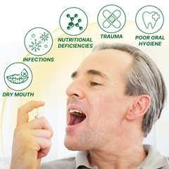 EELHOE 舌頭修護噴霧 修護舌苔發白緩解舌頭乾裂腫脹口腔護理噴霧