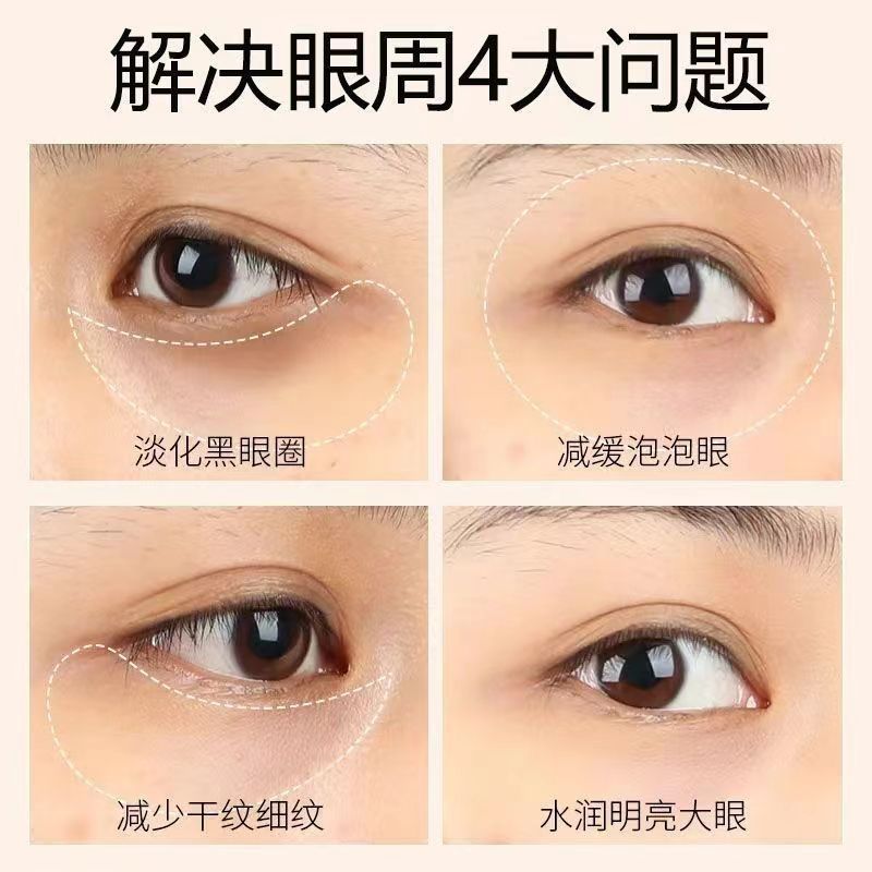 コラーゲンアイマスク、目の周りのシワ、小じわ、乾燥によるシワ、しわ、クマ、目袋を軽減し改善するアイマスク|undefined