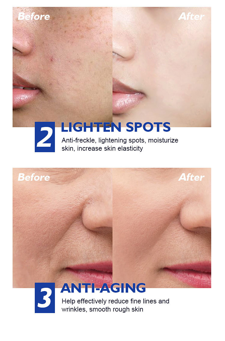 透明质酸维a醇视黄醇面霜批发抗皱抗初老紧致精华霜