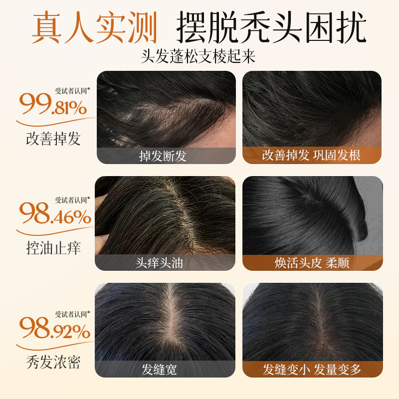 Qingling 脱毛防止および引き締めシャンプー、高麗人参、タデ、キキョウの葉、清潔で滑らか、髪の質の改善、夜更かしシャンプー|undefined