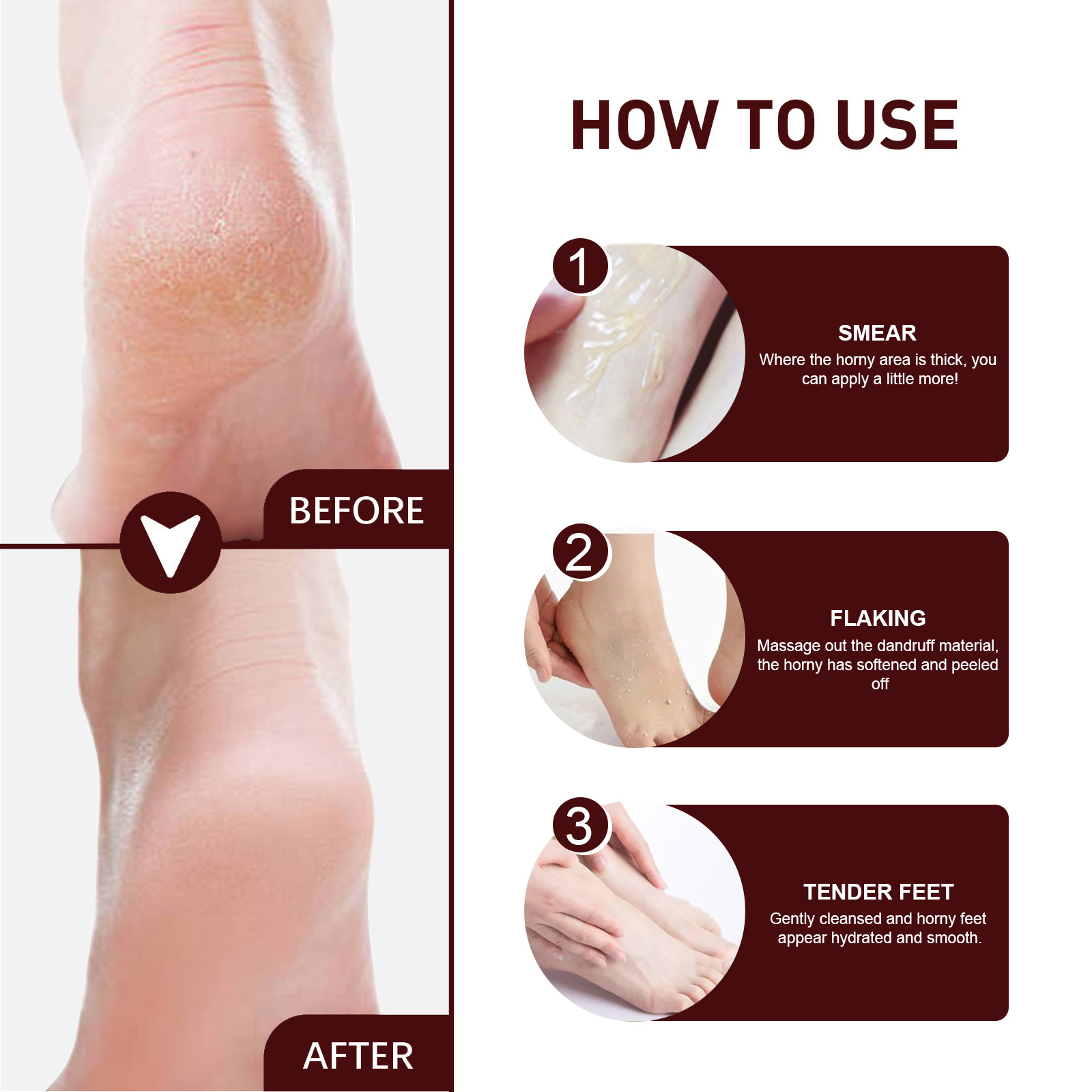 EELHOE Masaj Peeling Bakım Nemlendirici Kuru Çatlama, Soyulma ve Çatlama Karşıtı Ayak Koruma Kremi_voghion.com