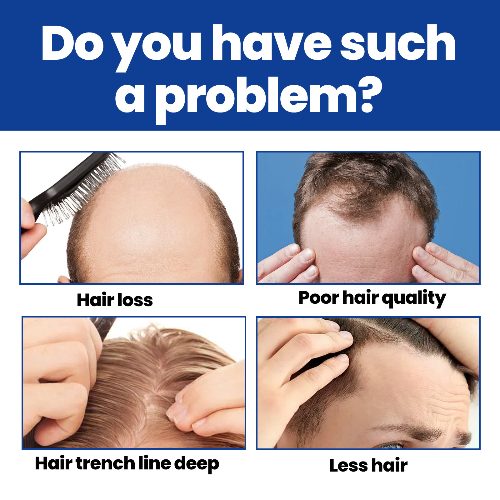 Moon Men's East foam Agent Chest Hair Beard Hairline Thick Growth Nutrition Liquid         line_voghion.com