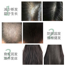 Polygonum multiflorum 育毛液、生毛液、毛包の急速成長、保湿、生え際、脱毛防止、毛髪固定エッセンス|undefined