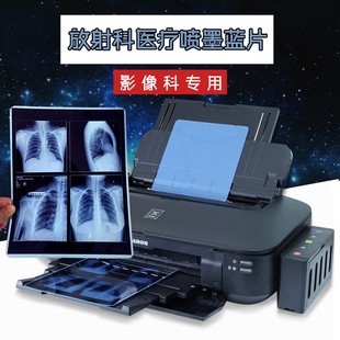 Inkjet blue medical film Blue Base dry radiology printing film dental fracture X-ray film DR CR CT
