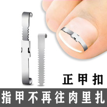 正甲扣嵌甲矫正器正甲贴卷甲拉拉甲丝甲沟矫正脚趾甲往肉里长垫炎