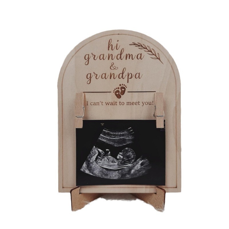 Marco de fotos de madera Baby B-Ultra NT Marco de fotos de almacenamiento de ultrasonido Doppler color de cuatro dimensiones