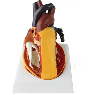 Enovo Tetralogy of Fallot Correction Congenital Heart Model Tof Heart Malformation Cardiac Surgery Model