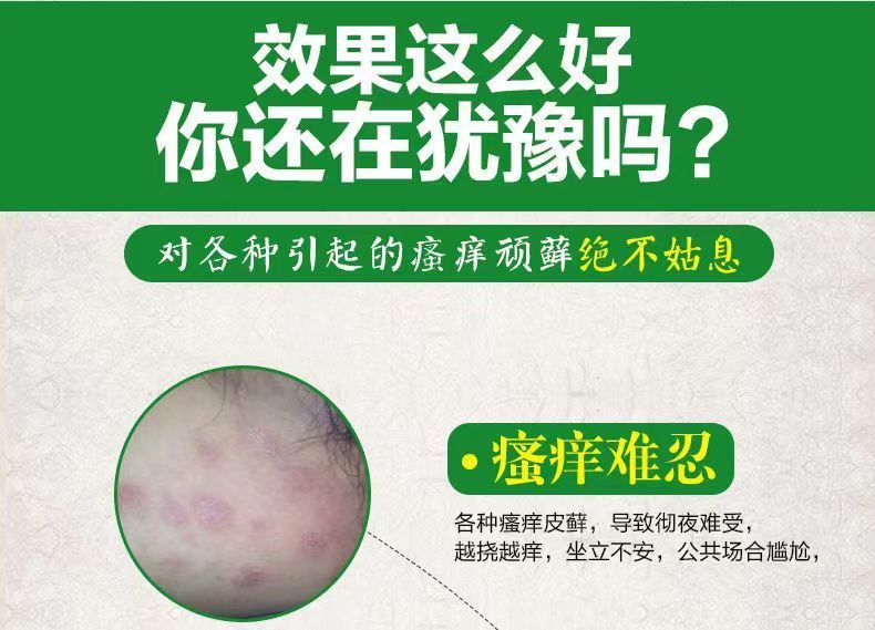 皮膚看護保健液今日の扁鵲は皮膚の濡れかゆみを緩和します。|undefined
