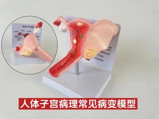 Female pathological uterine model maternal and reproductive ovarian uterine structure Anatomy advanced simulation morbid uterine model