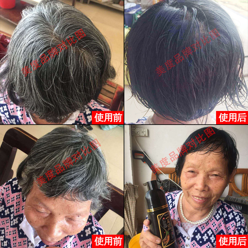 美度黒科技易洗黒染毛剤植物一本黒染毛クリーム白転黒一洗彩潤黒露禅洗|undefined