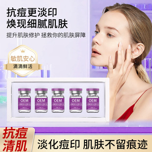 Salicylic Acid Anti-Acne Hydrating Essence Improves and Fades Acne Marks, Eliminates Acne, Smoothes Skin, and Is Specially Designed for Beauty Kits