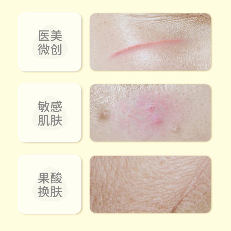 現物葵花医療用再編成コラーゲン修復貼付補水皮膚修復医療用マスクのサイズ|undefined