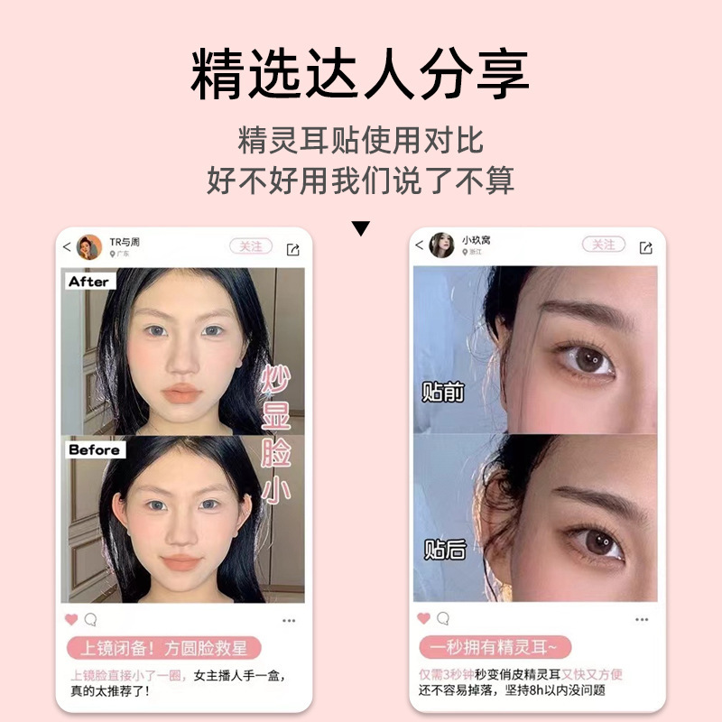アップグレードされた箱入り蝶型エルフ耳ステッカー、女の子のような耳ステッカー、大きな顔、小さな顔、耳が目立つ耳ステッカー|undefined