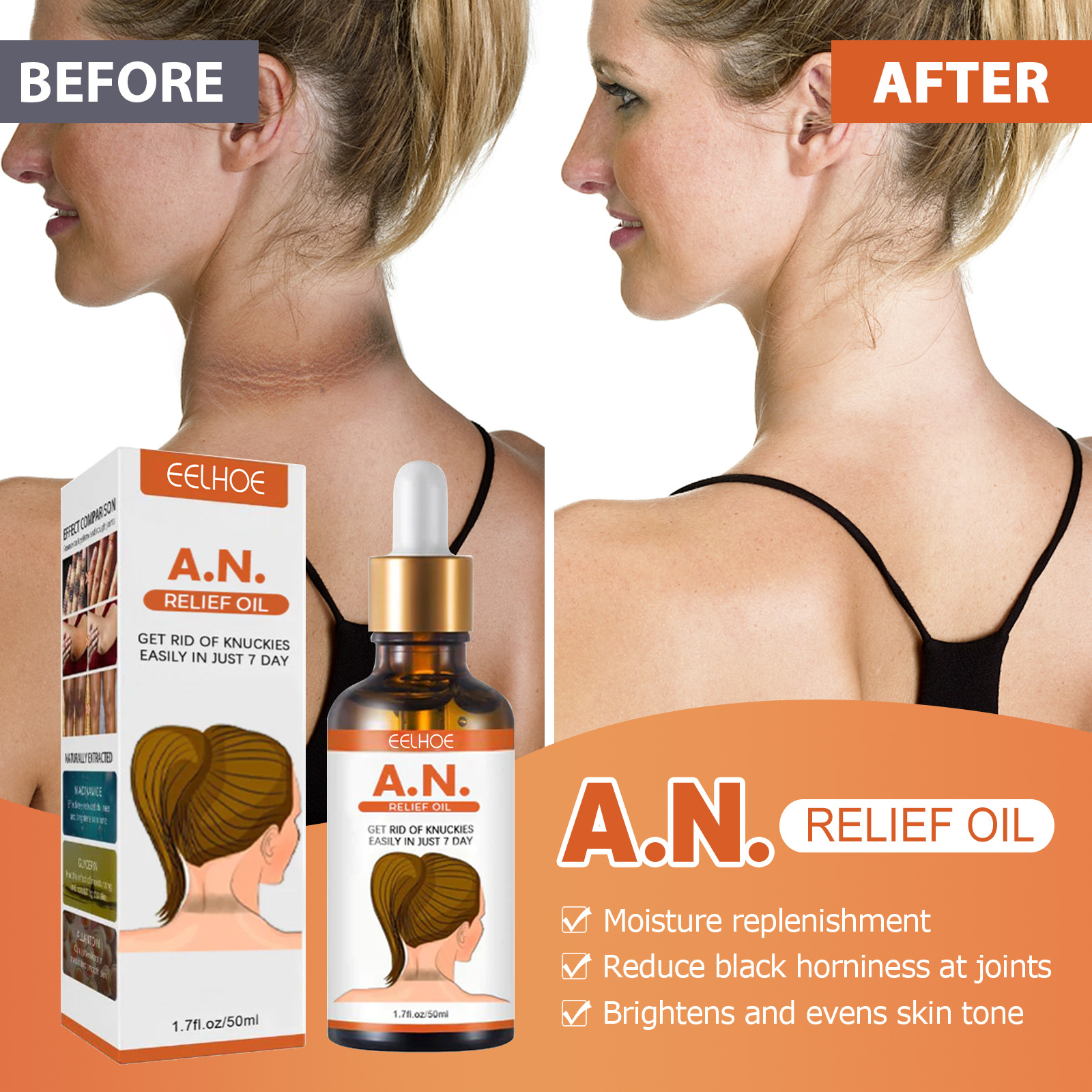 EELHOE Blackning&Whitning Essntial Oil Arm Axillary Joint Moisturizing&Brightning Evn Skin Color Exfoliating_voghion.com