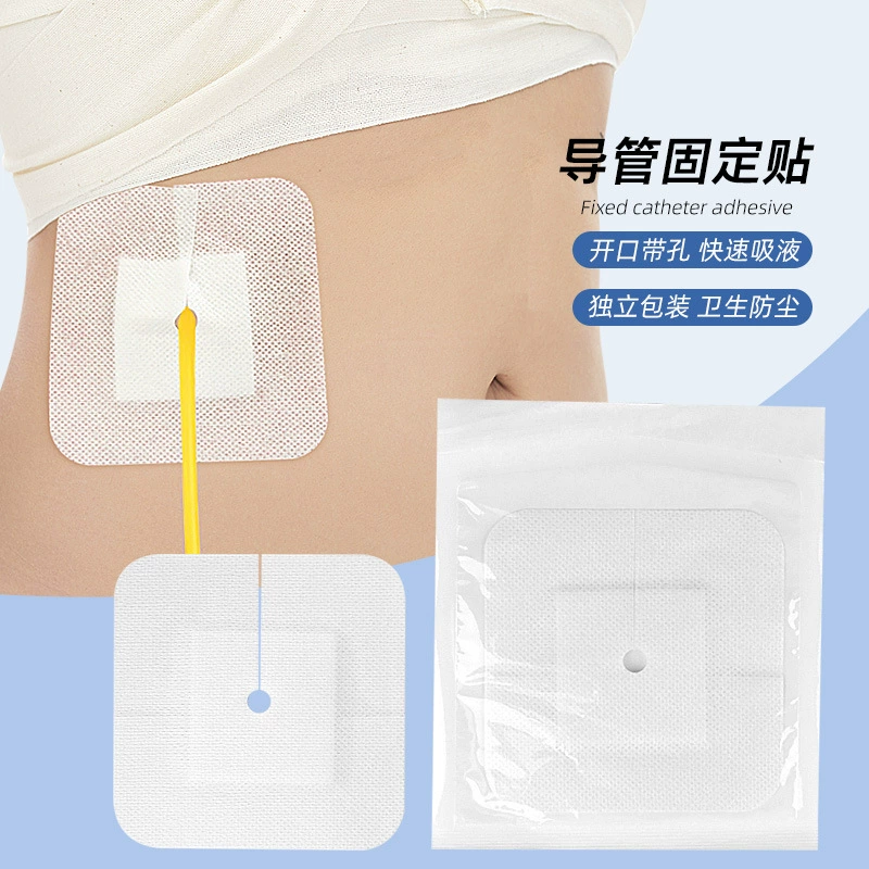 Нетканая дренажная трубка поставляется с повязкой с открытым отверстием, повязкой для фиксации мочевого катетера на поверхности тела для абдоминального диализа, цельная, независимая упаковка.
