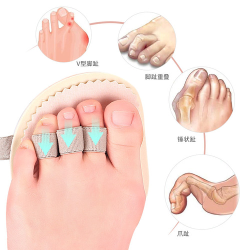 Toe pads, split toes, forefoot pads, hallux valgus overlapping, breathable, sweat-absorbent, anti-wear, anti-pain forefoot pads