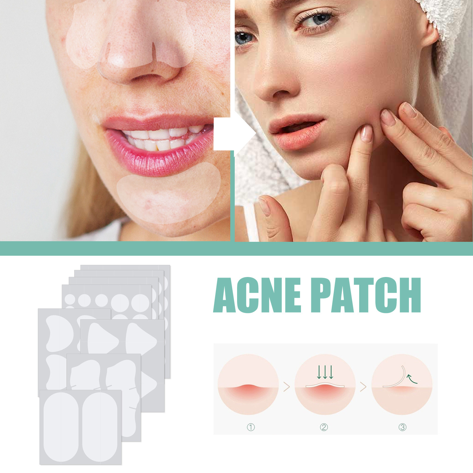EELHOE Removing facial mask Mild and Non irritating Lighten Marks Healing Acne Repair Patch_voghion.com