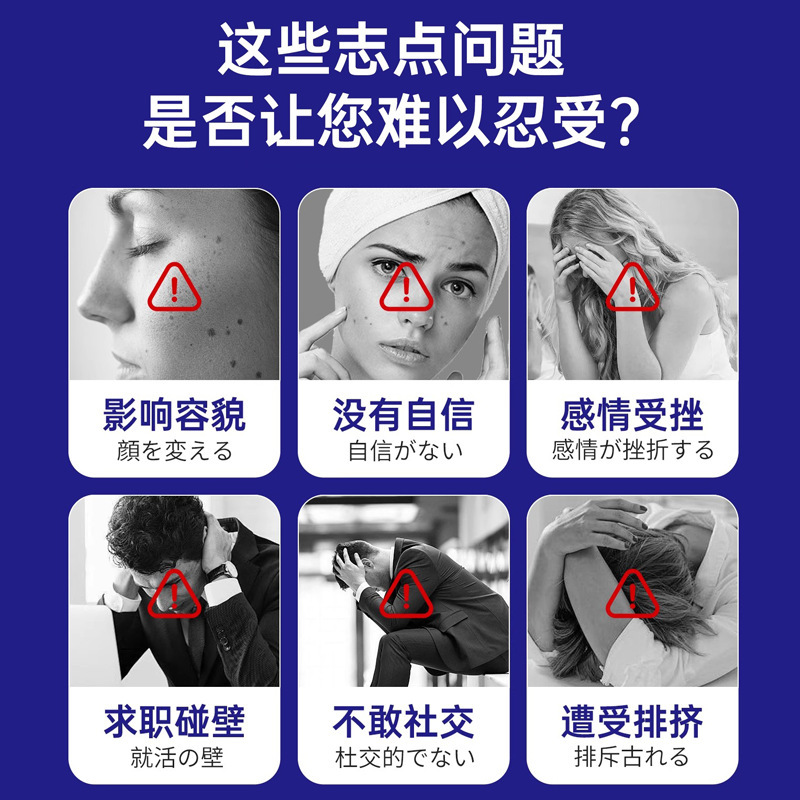 安井川药业点痣膏套盒点痣液黑痣痦子瘊子肉刺脂肪粒点痣膏点斑膏|undefined
