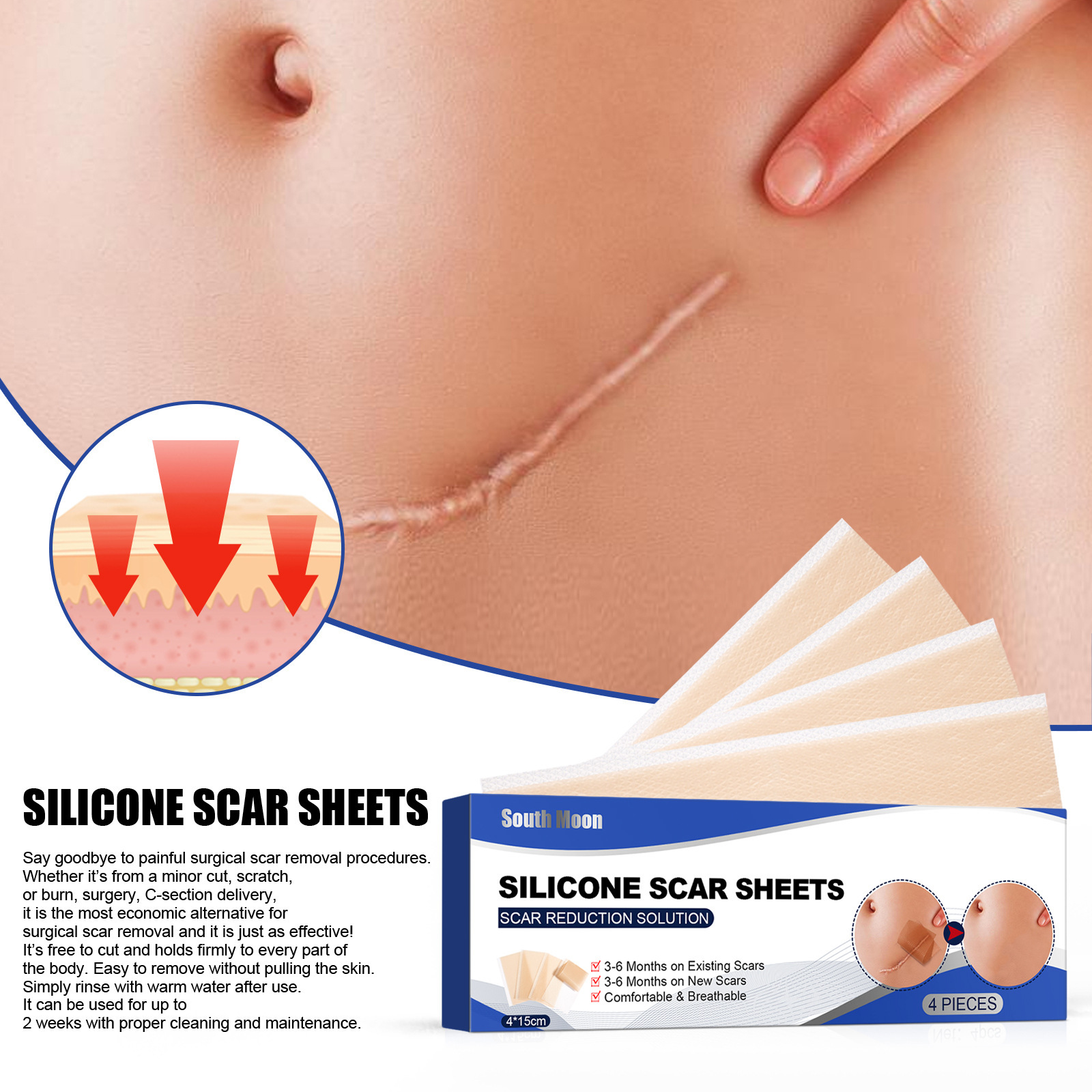South Moon self-adhesive silicone scar patch repair burn scars smooth skin skin wound care patch_voghion.com