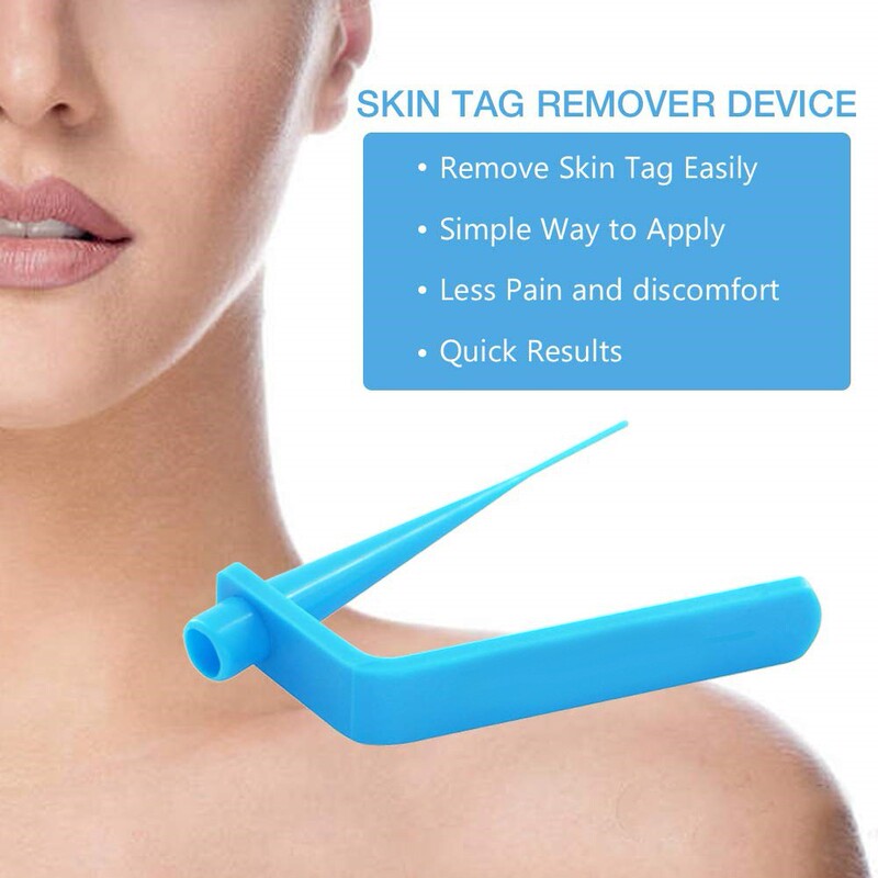 Skin Tag Removal Tool Set, Silk Wart Removal Tool, Skin Tag Removal Tool, Best Selling on Amazon