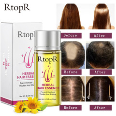RtopR Oil-Free Herbal Hair Growth Thickening Essential RtopR021 New Packaging
