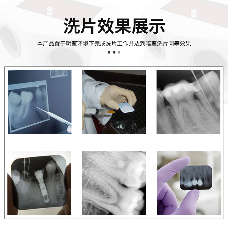 Película de radiografía dental simple caja encubierta película dental manual lavadora película de rayos X lavado encubierto caja equipo de lavado dental image 3