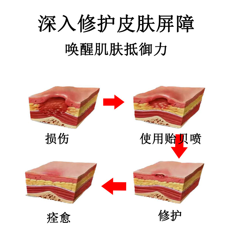 贻贝修复喷雾修红血丝退红退敏修复脆弱肌激素脸屏障修复安肤舒缓|undefined