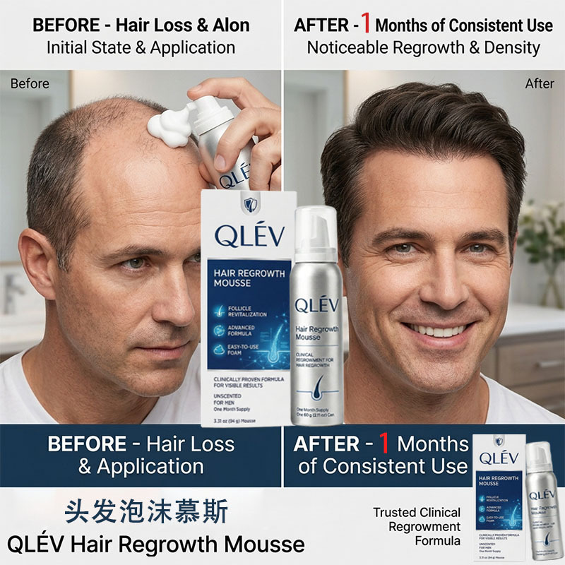 Southeast Asia Cross-Border Hair Growth Foam Mousse Hairline Nutrient Solution Hair Essence Foreign Trade Small Batch Oem