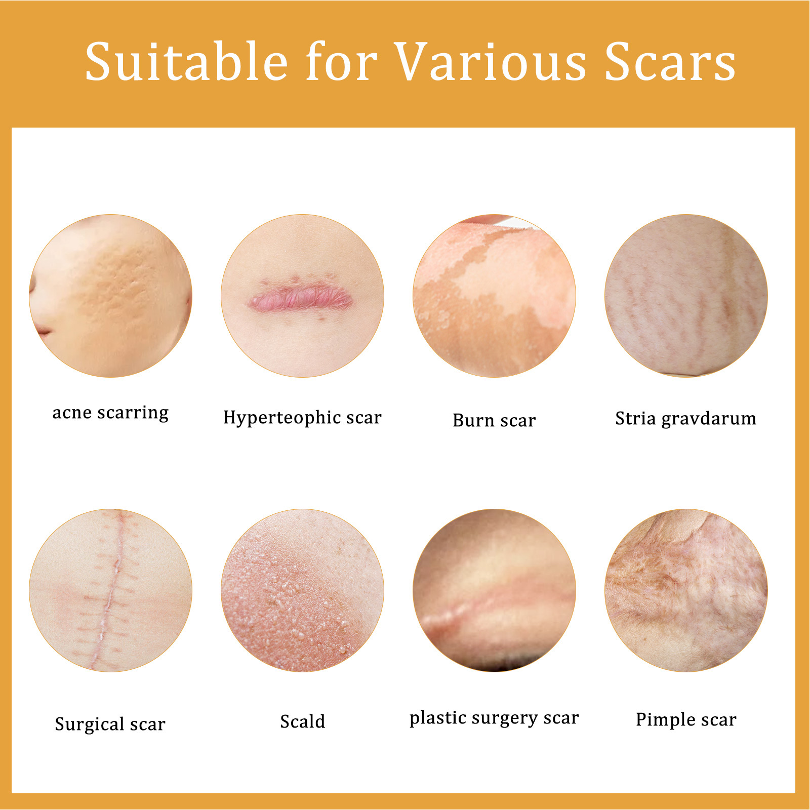 EELHOE Scar Cream Fading Hud Trauma Reparation Forbrænding Forbrænding Fading Cream Kirurgisk reparation Scar Scar Cream_voghion.com