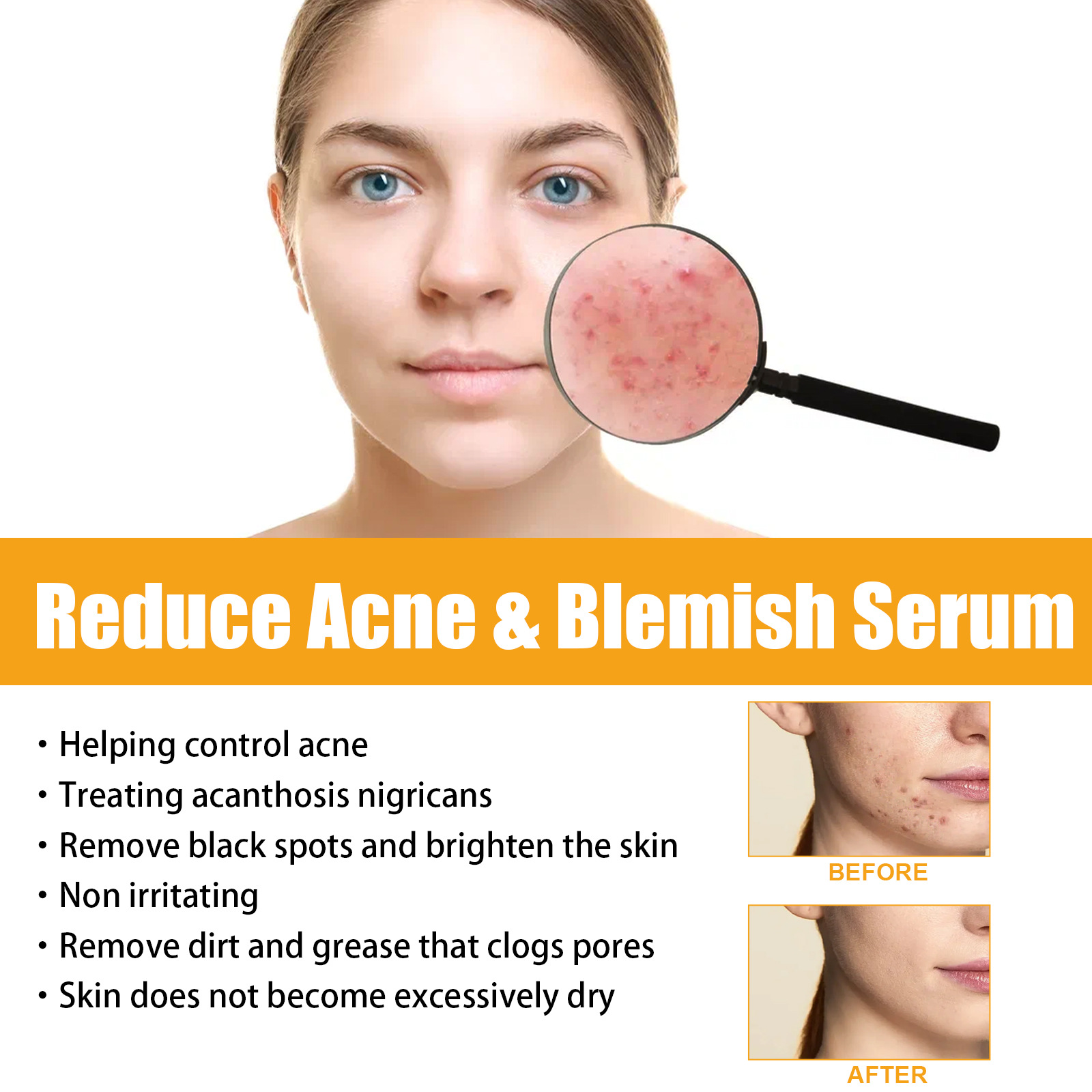 Jayusing Anti Cream Lighten and Acne Marks Esencja do nawilżania i naprawy skóry na ustach_voghion.com