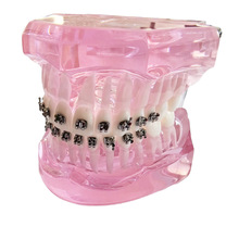 ���ƿ�ǻ���X�̌Wģ������չʾ���f������ͨ���fģ�ͽ����в�