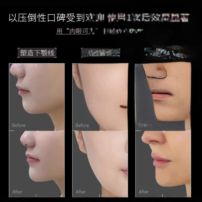 韩国丽菲同款5D绷带面膜 提拉紧致脸部塑形保湿淡化细纹面膜|undefined