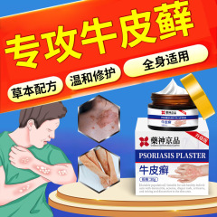 Yaoshen Jingpin 乾癬かゆみ止め軟膏は、頑固な外用皮膚のかゆみ、赤み、中頭皮株を殺菌します。